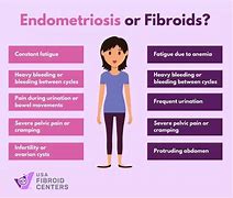 Image result for 14 Cm Fibroid