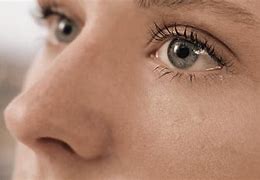 Image result for Nose Wrinkles
