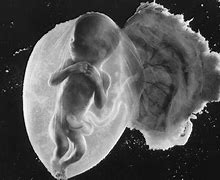 Image result for 18 Week Baby in Womb
