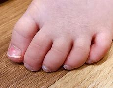 Image result for Curved Foot