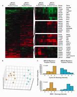 Image result for Hereditary BRCA2 Mutation Profile Expression
