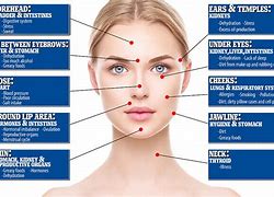 Image result for Face Mapping Acne Zones