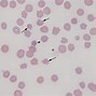 Image result for Ghost Cells in Physiology