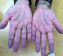 Image result for Hand Tinting Photos