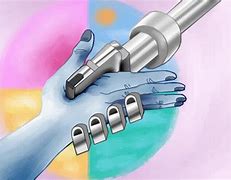 Image result for prosthetic hands