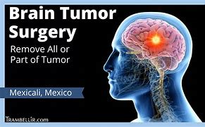 Image result for Brain Tumor Operation