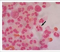Image result for CSF Gram Stain