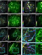 Image result for Brain Cells Microscope