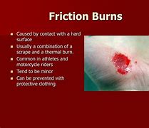 Image result for Skin Friction Pile