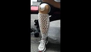 Image result for Temporary Prosthetic Leg