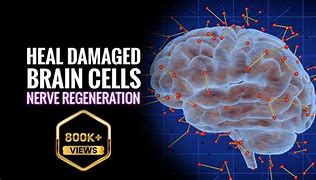 Image result for Brain Cell Regeneration