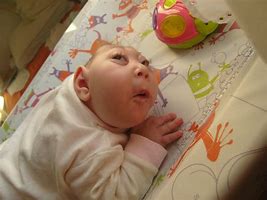 Image result for Acephalic Baby