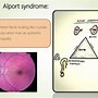Image result for Cone-Rod Dystrophies