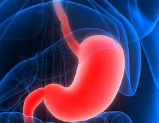 Image result for Stomach Cancer