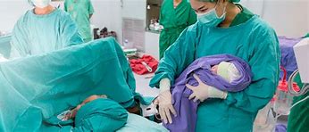 Image result for cesarean section