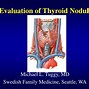 Image result for Red-Flag Us Thyroid