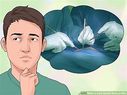 Image result for How You Get Genital Warts