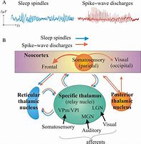 Image result for Sleep Spindles