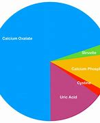 Image result for Size Chart for Kidney Stones