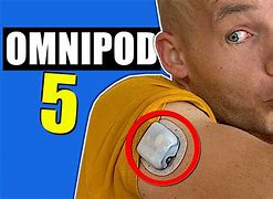 Image result for OmniPod 5 Placement