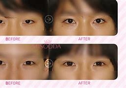 Image result for Double Eyelid Sticker