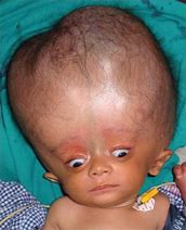 Image result for Big Head Baby