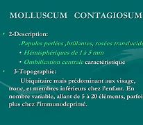 Image result for Pathogenesis of Molluscum Contagiosum