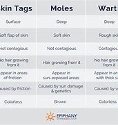 Image result for Warts and Skin Tags