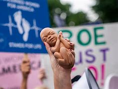 Image result for Aborted Fetal