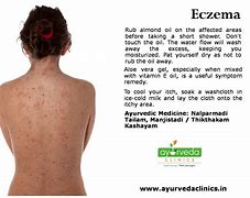 Image result for Allergic Eczema Symptoms