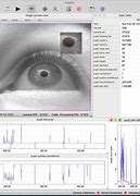 Image result for Computer Eye Strain