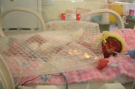 Image result for Tiny Premature Baby Boys