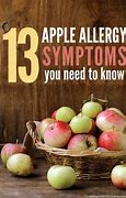 Image result for Green Apple Allergy