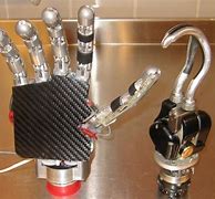 Image result for Prosthetic Claw Hand