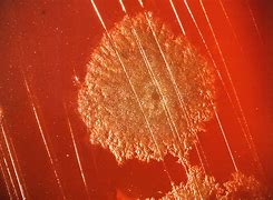 Image result for Chlamydia Gram Stain