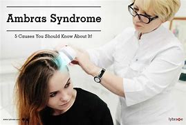 Image result for Ambras Syndrome