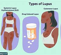 Image result for Skin Lupus