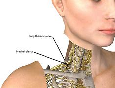 Image result for Thoracic Nerve Damage Symptoms