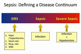 Image result for Sepsis Stages