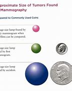 Image result for How Big Is a 2 Cm Cyst