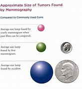 Image result for 4 Cm Tumor