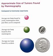 Image result for How Big Is a 12Mm Tumor