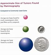 Image result for How Big Is 1 Cm Tumor