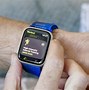Image result for Iwatch Bands with Sensors