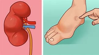 Image result for How I Lost My Kidney Meme Woman