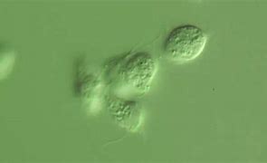Image result for Trichomonas Under Microscope