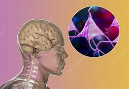 Image result for Human Head and Brain and Neurons