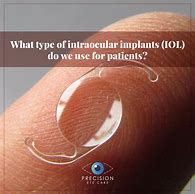 Image result for Accommodating Intraocular Lens Implant