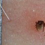 Image result for Animal Lice