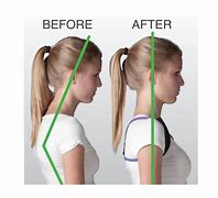 Image result for Posture Corrector Before and After